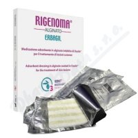 RIGENOMA alginátové krytí s OZOILE 5ks