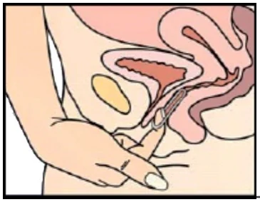 F:\User.Dat\Supply_Chain Farma\Diseños\IMAGENES ANILLO\IMAGEN-8.jpg