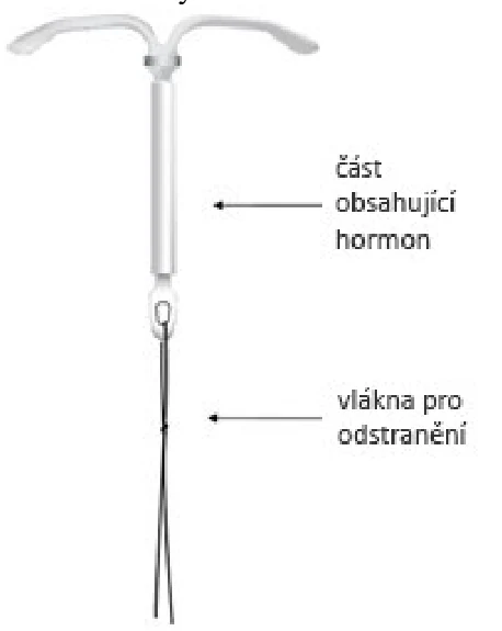 Obrázek 1: Kyleena