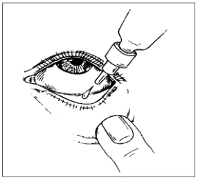 Demonstrating how to use eye drops (Obdélník)