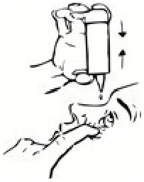 H:\REG\1-FILE\JOZ\CORE\e-CTD EU\ValRep + Words\0003_D106\0003_DOCS INTERNES\4- Module 1\3- Updated Product Information DUOKOPT\2- Image pour PIL compliant GED\4.png
