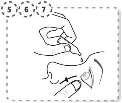 schema_tirer_paupiere_bas_instiller_goutte_unidose_567-V1-20151105