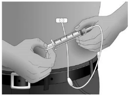 If the needle was not inserted properly, repeat the priming and insertion of the needle
